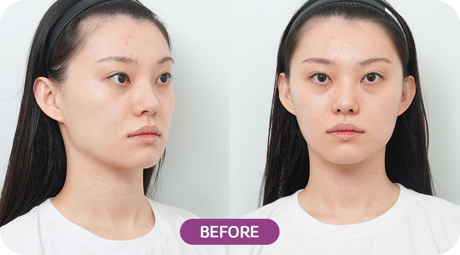 Before 영상