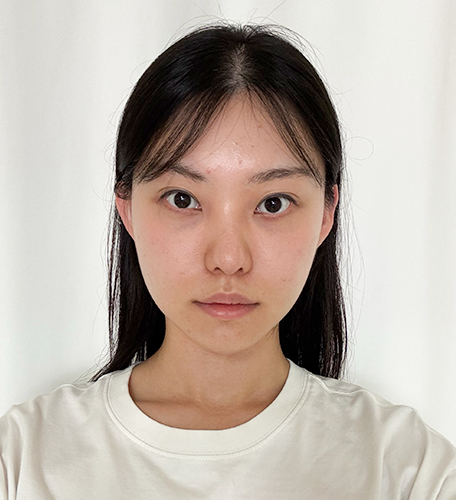 수술 30일 후