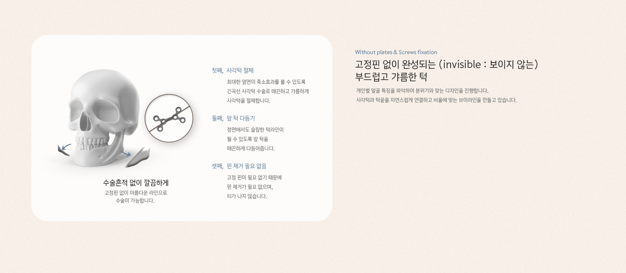 고정핀 없이 완성되는 (invisible : 보이지 않는) 부드럽고 갸름한 턱. 개인별 얼굴 특징을 파악하여 분위기와 맞는 디자인을 진행합니다. 사각턱과 턱끝을 자연스럽게 연결하고 비율에 맞는 브이라인을 만들고 있습니다.