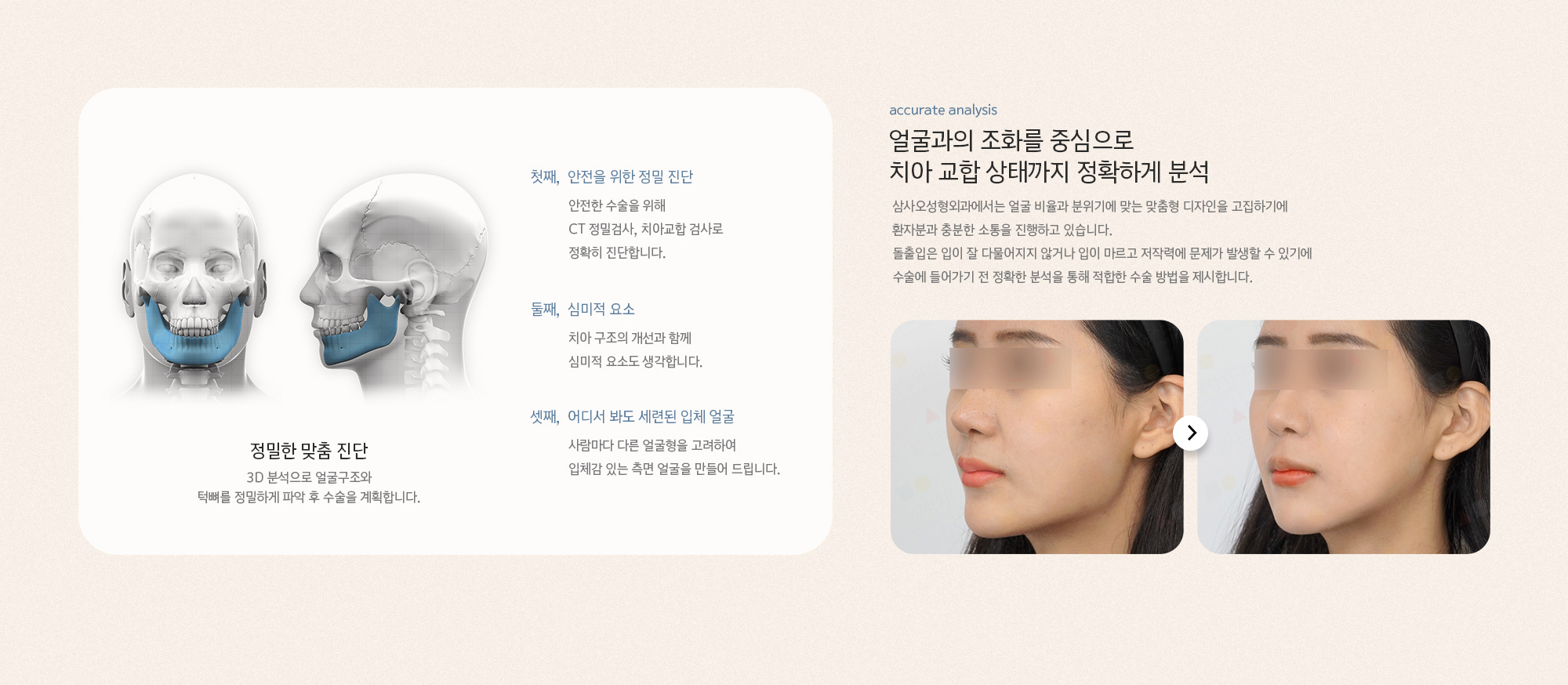 양악수술은 단 1mm 의 오차에도 큰 차이가 나는 고난이도 수술이기 때문에 정확한 분석과 진단을 통해 수술 플랜을 수립해야 합니다. 삼사오성형외과에서는 양악의 기본인 치아 교합을 바탕으로 얼굴뼈는 물론 연부조직까지 고려하여 기능과 심미적인 부분 모두를 개선합니다. 
