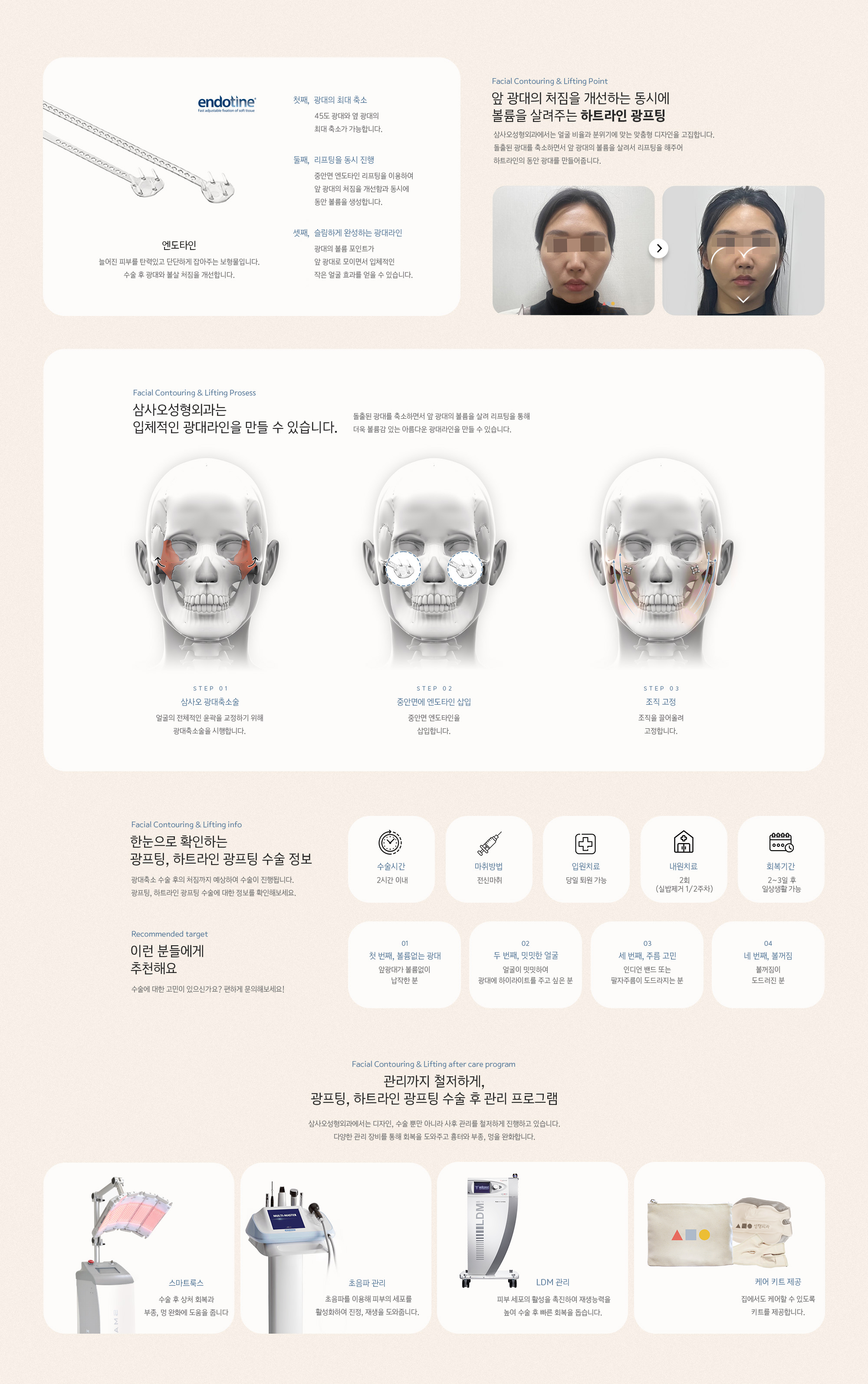 앞 광대의 처짐을 개선하는 동시에 볼륨을 살려주는 하프라인 광프팅