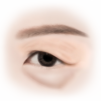 BEFORE 이미지