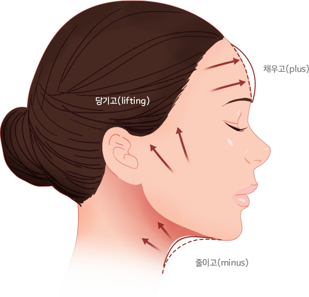 플마 리프팅 이미지