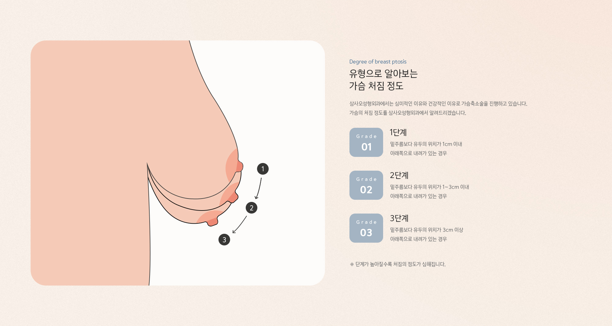 삼사오성형외과에서는 심미적인 이유와 건강적인 이유로 가슴축소술을 진행하고 있습니다.