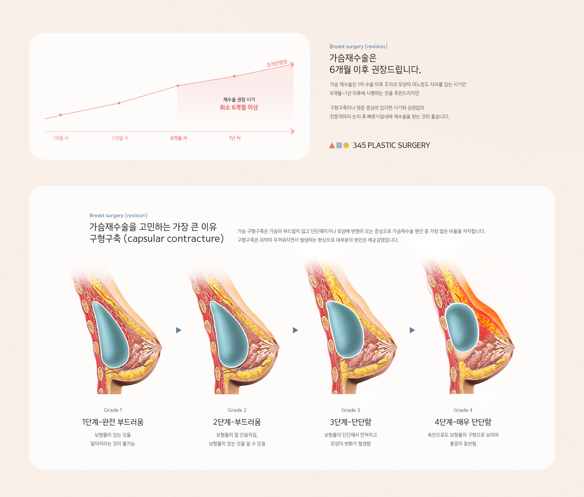 가슴재수술은 6개월 이후 권장드립니다. 가슴 재수술은 1차 수술 이후 조직과 모양이 어느정도 자리를 잡는 시기인 6개월~1년 이후에 시행하는 것을 추천드리지만 구형구축이나 염증 증상이 있다면 시기와 상관없이 전문의와의 논의 후 빠른시일내에 재수술을 받는 것이 좋습니다.