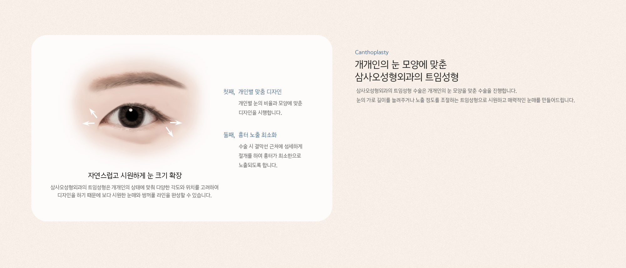 개개인의 눈 모양에 맞춘 삼사오성형외과의 트임성형