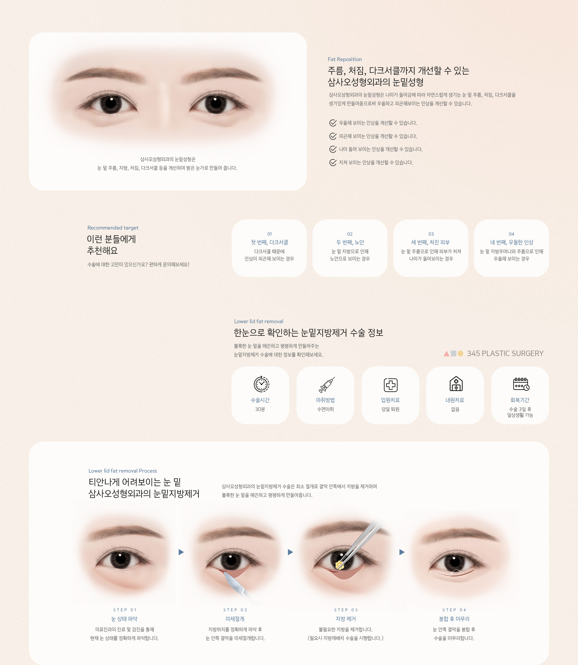 주름, 처짐, 다크서클까지 개선할 수 있는 삼사오성형외과의 눈밑성형. 삼사오성형외과의 눈밑성형은 나이가 들어감에 따라 자연스럽게 생기는 눈 밑 주름, 처짐, 다크서클을 생기있게 만들어줌으로써 우울하고 피곤해보이는 인상을 개선할 수 있습니다.