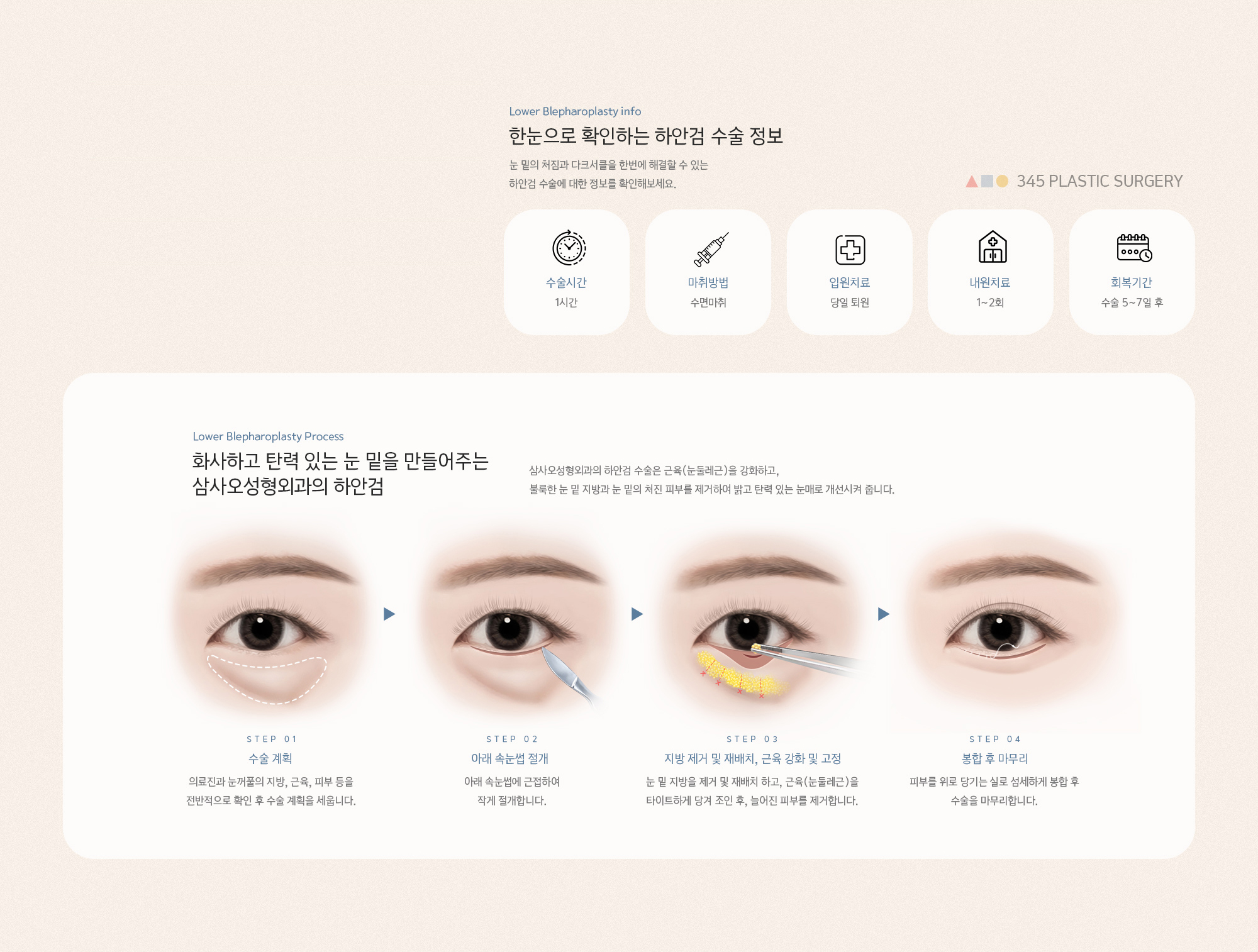 화사하고 탄력 있는 눈 밑을 만들어주는 삼사오성형외과의 하안검. 삼사오성형외과의 하안검 수술은 근육(눈둘레근)을 강화하고, 불룩한 눈 밑 지방과 눈 밑의 처진 피부를 제거하여 밝고 탄력 있는 눈매로 개선시켜 줍니다.